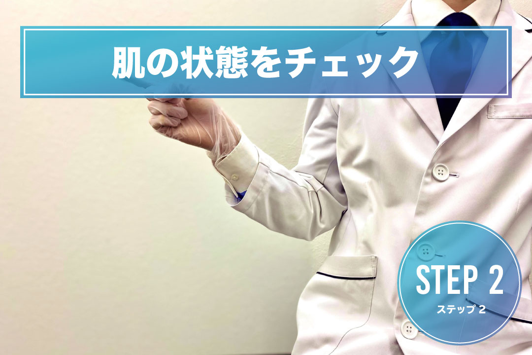 手の甲脱毛Step2