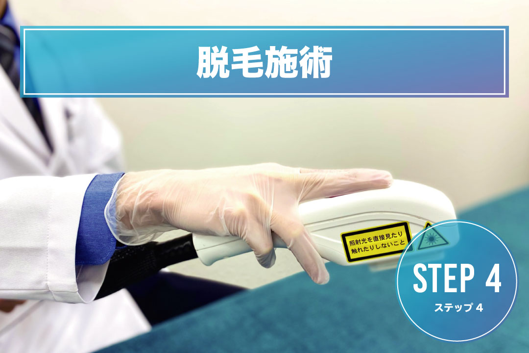 手の甲脱毛Step4